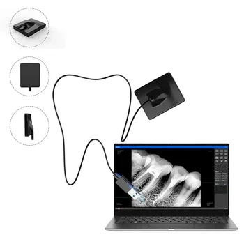 Стоматологический цифровой рентгеновский датчик RVG Intraoral Image System с программным обеспечением Eco Sensor Подходит для нескольких рентгеновских аппаратов