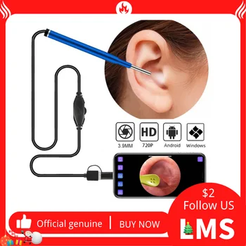 Отоскоп LMS CAP 3,9 мм, USB-ушной эндоскоп, камера для осмотра Лор-органов, камера для осмотра носа, камера для взрослых и детей на телефоне Android ПК